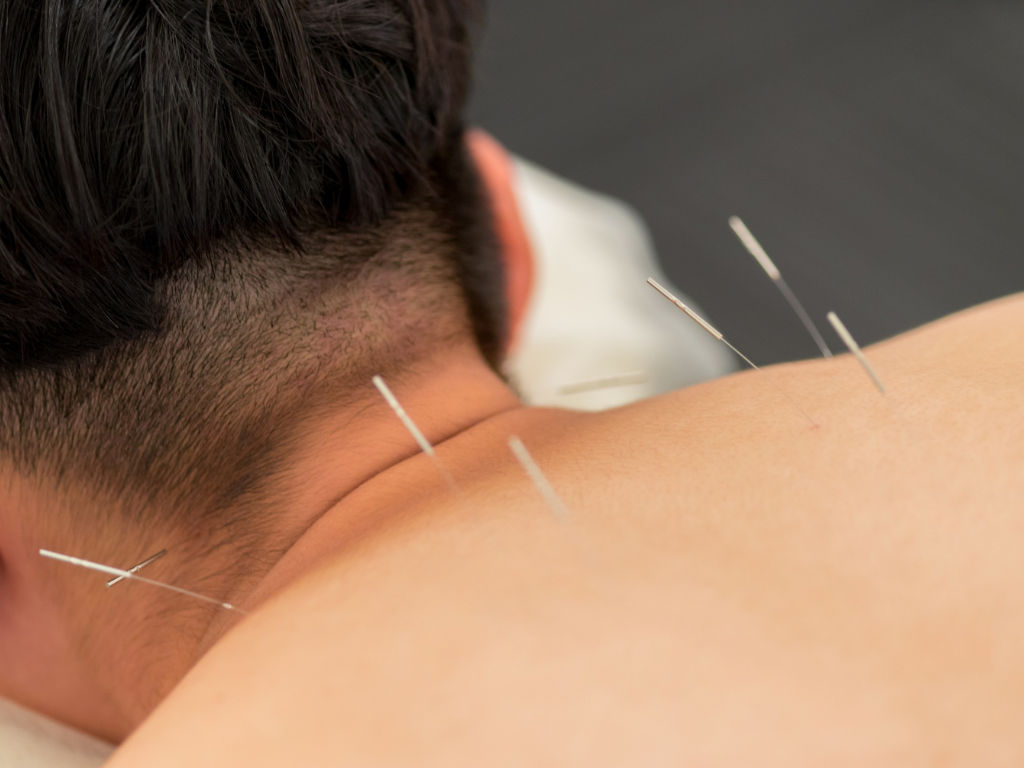 What does the needle actually do to the muscle?