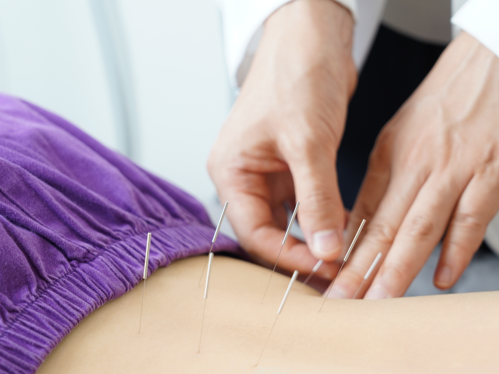 Does dry needling actually work for back pain?