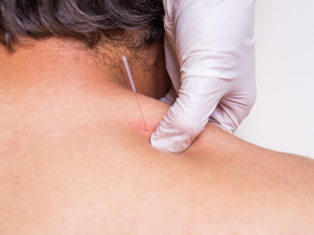 What does dry needling feel like when the muscle twitches?