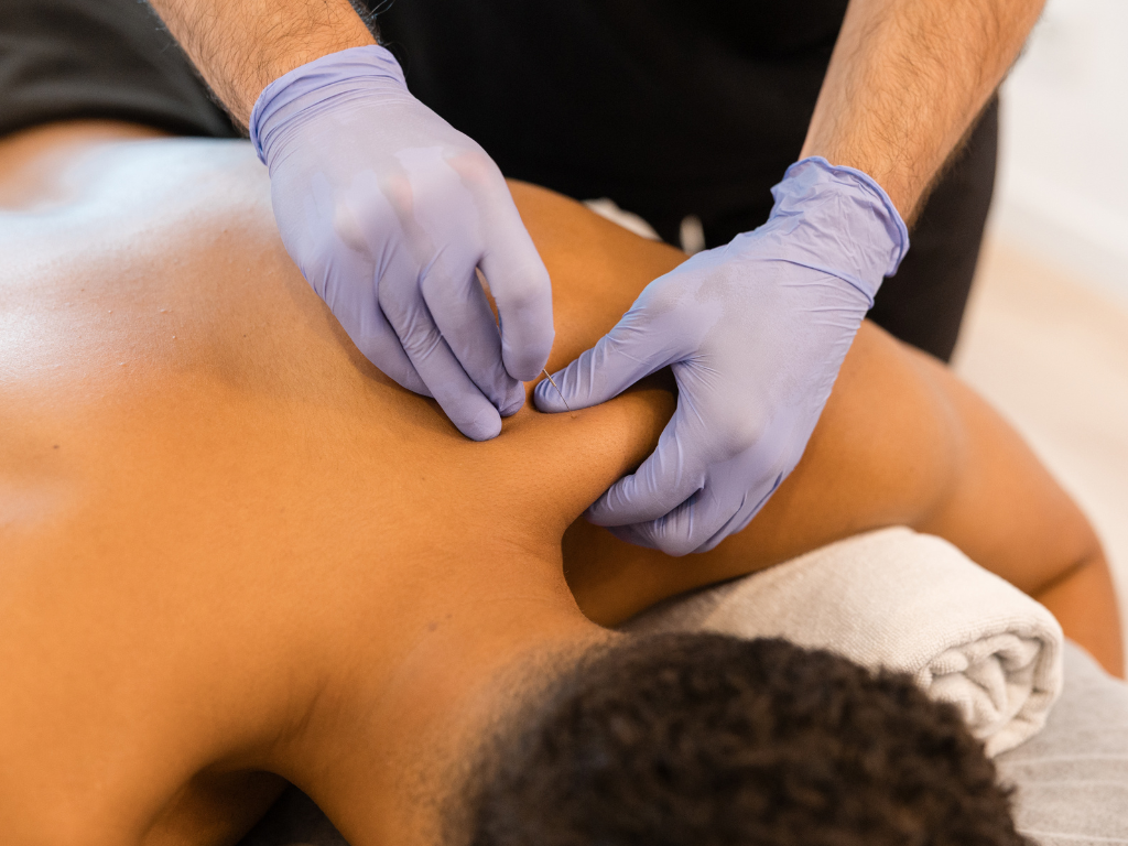How long does dry needling take to work?