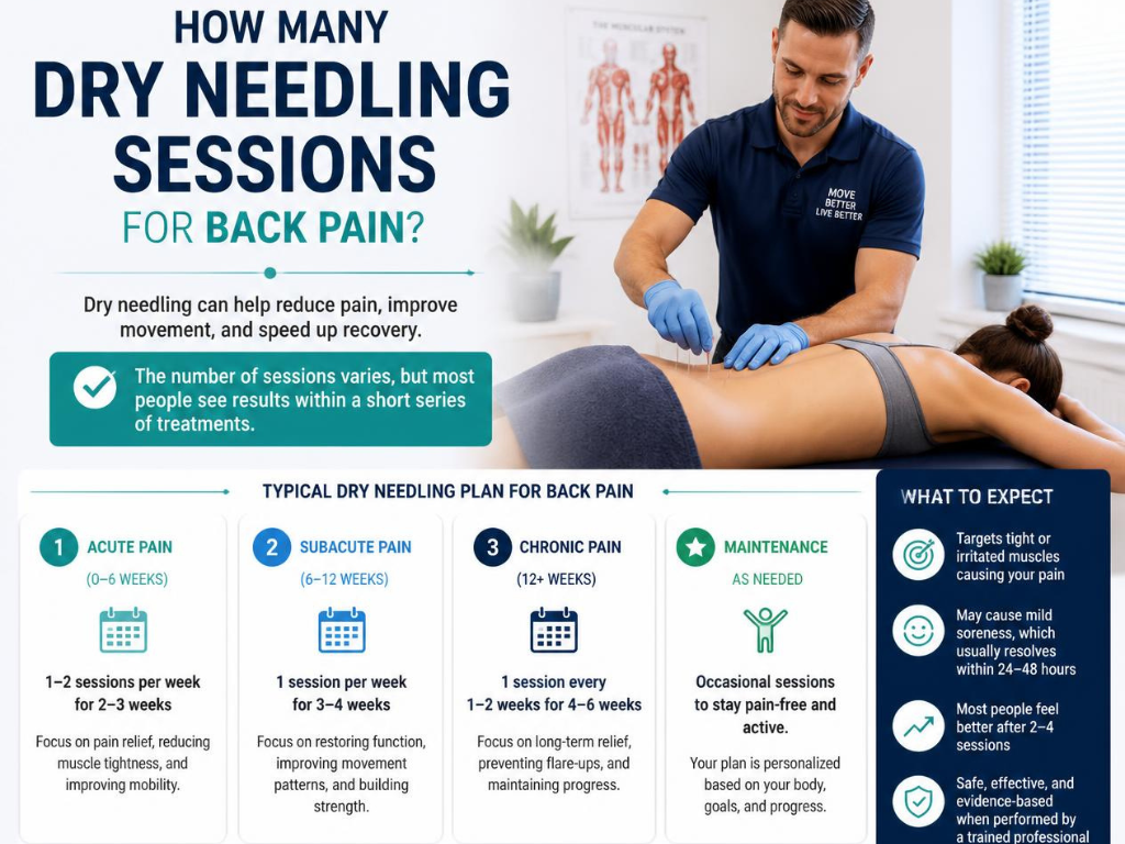 How Many Dry Needling Sessions for Back Pain?